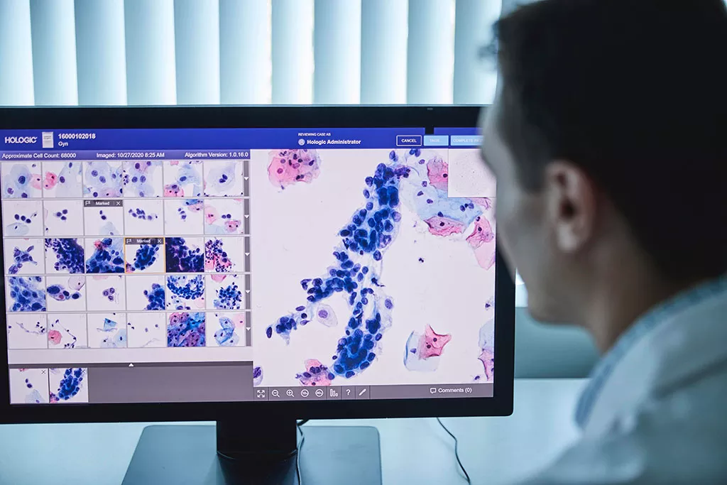 A lab worker is looking at cervical cells on the Genius Review Station monitor