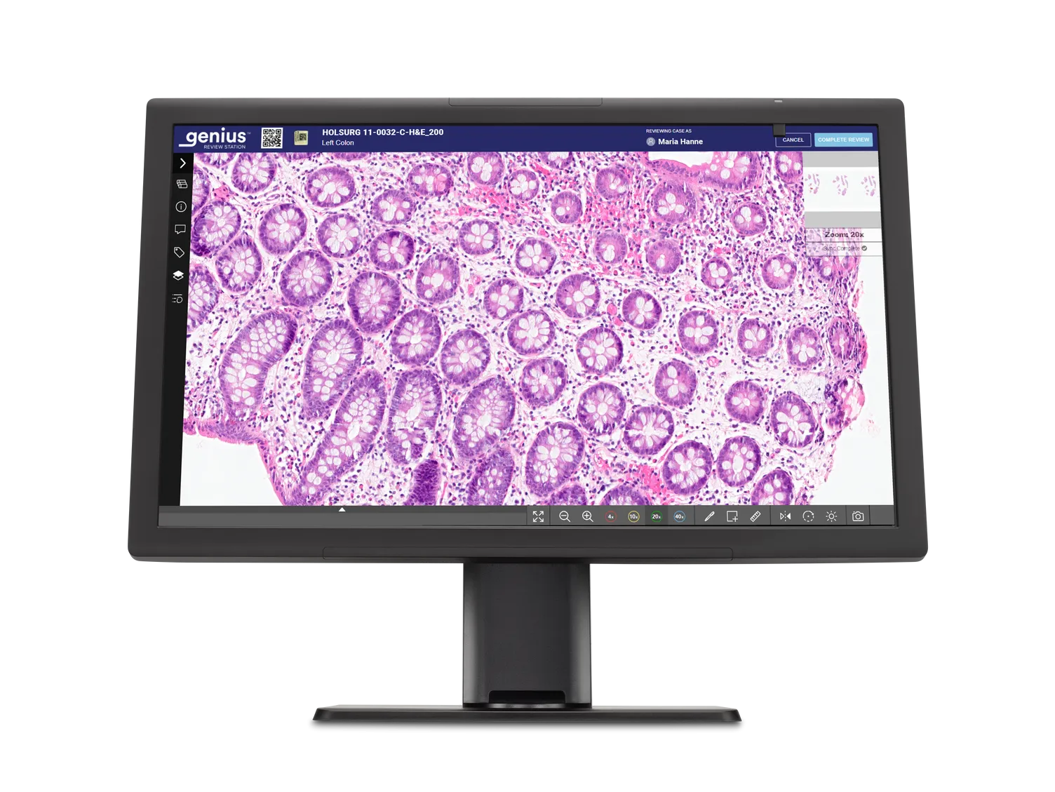 Genius monitor showing histology cells ready for review