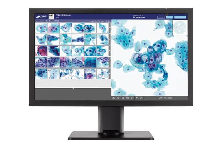 Genius monitor showing cytology cells ready for review